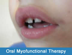 Oral Myofunctional 65